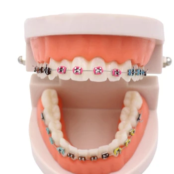 1pc Dental Tratamento Ortodôntico Modelo Com Ortho Suporte de Metal Arco de Arame Bucal Tubo de Ligadura Laços Dental Modelo Padrão